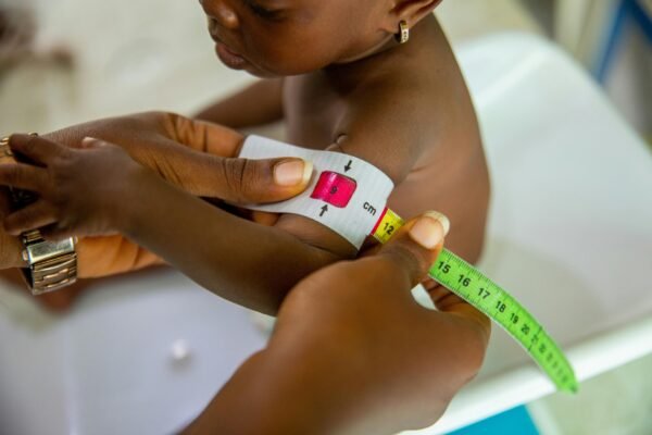 Child Malnutrition: India’s Failing Battle Against Child Hunger 4 Child Malnutrition